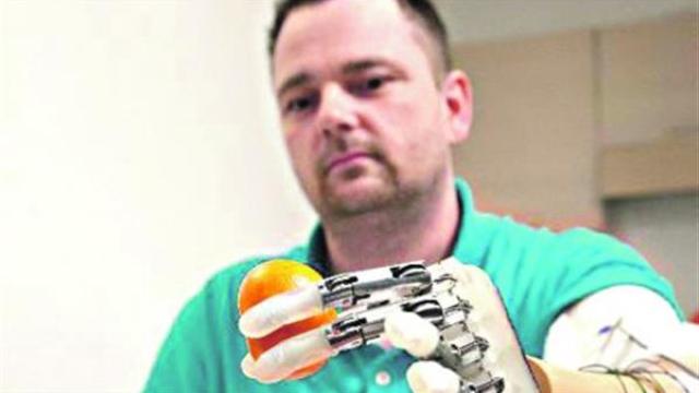 Naučnik iz Srbije konstruiše revolucionarnu bioničku ruku 